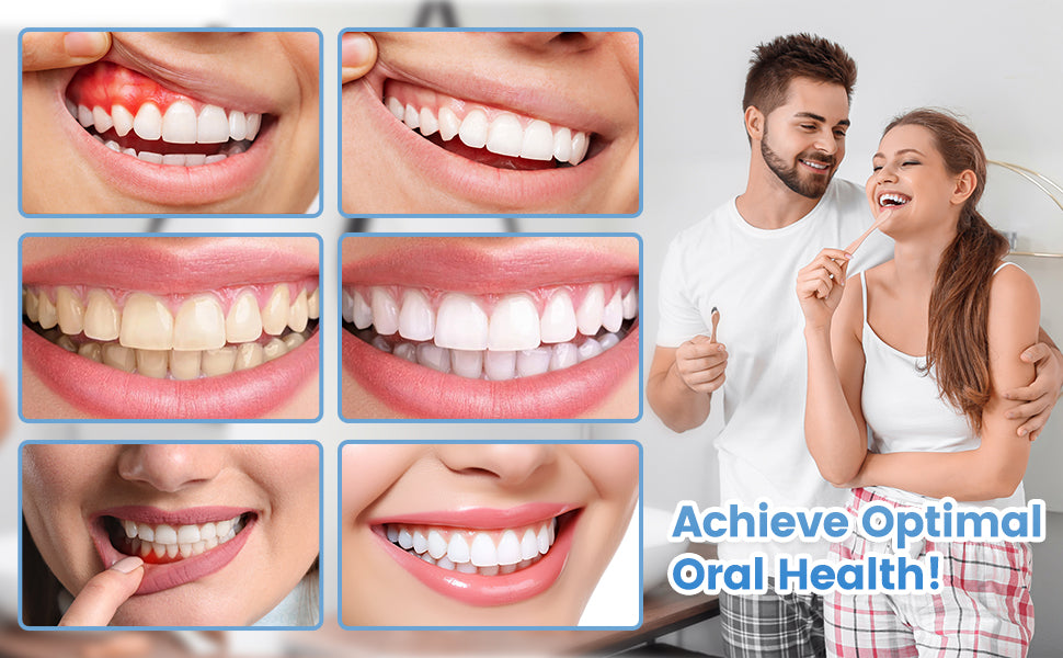 7.5% Nano Hydroxyapatite Fluoride Toothpaste